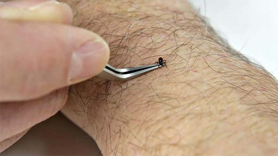tick-removal-tool